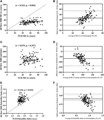 Cerebral hemodynamics comparison using transcranial doppler ultrasound and 4D flow MRI